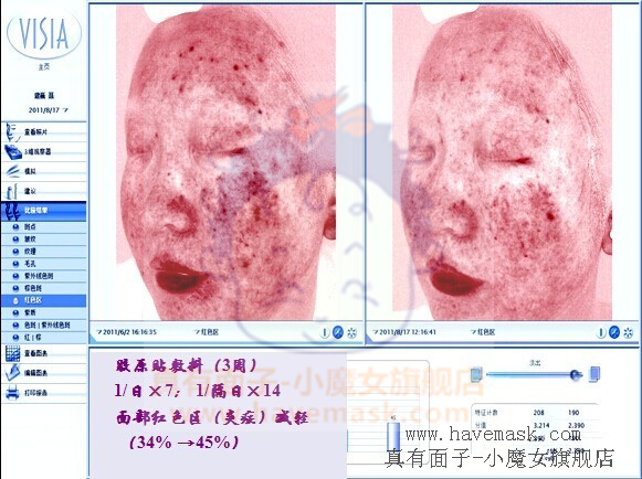 ��������ԭ��Ĥ�ٴ�Ӧ�÷���