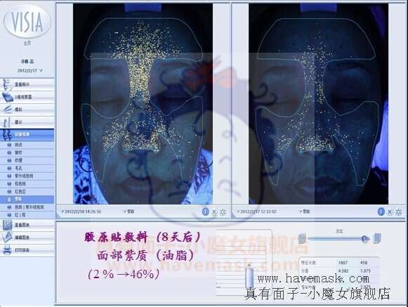 ��������ԭ��Ĥ�ٴ�Ӧ�÷���