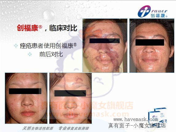 ��������ԭ��Ĥ�ٴ�Ӧ�÷���