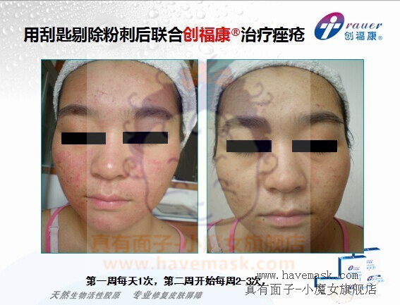 ��������ԭ��Ĥ�ٴ�Ӧ�÷���