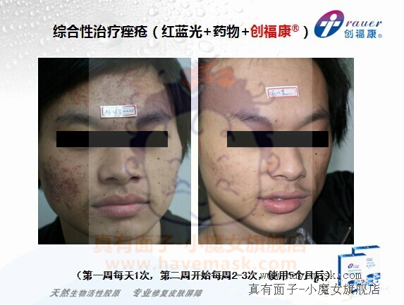 ��������ԭ��Ĥ�ٴ�Ӧ�÷���