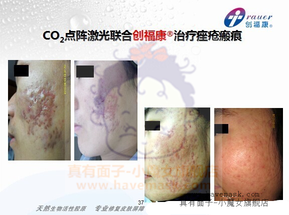 ��������ԭ��Ĥ�ٴ�Ӧ�÷���