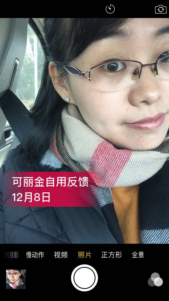 图下这位美女因为卸妆不彻底+暴晒导致皮肤敏感+红血丝…… 坚持使用可丽金半年后成功修复了肌肤屏障，现在 ...