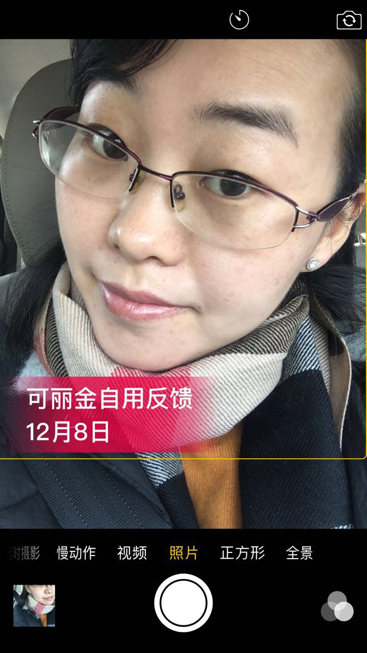 图下这位美女因为卸妆不彻底+暴晒导致皮肤敏感+红血丝…… 坚持使用可丽金半年后成功修复了肌肤屏障，现在 ...